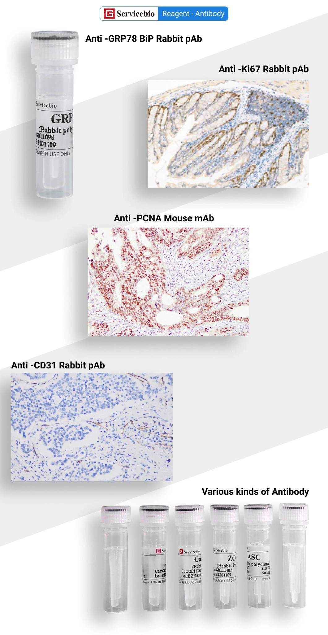 Recombinant Mouse Monoclonal Anti-Beta III Tubulin Antibody