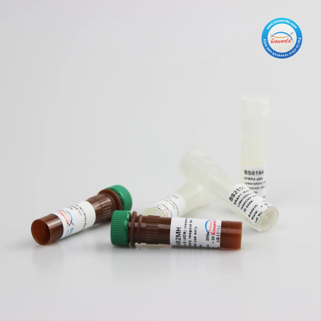 CE, ISO9001 Approved Ptx3 (Y27) Polyclonal Antibody