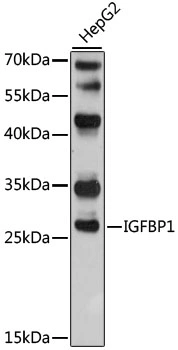 Igfbp1 Polyclonal Antibody