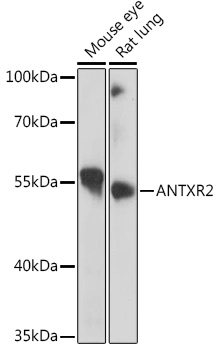 Anticorps polyclonal Antxr2